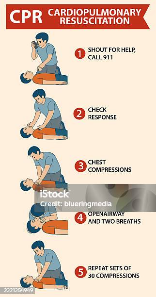 Cpr Stepwise Stepbystep Cpr Instructional Vector Illustration Stock Illustration ...