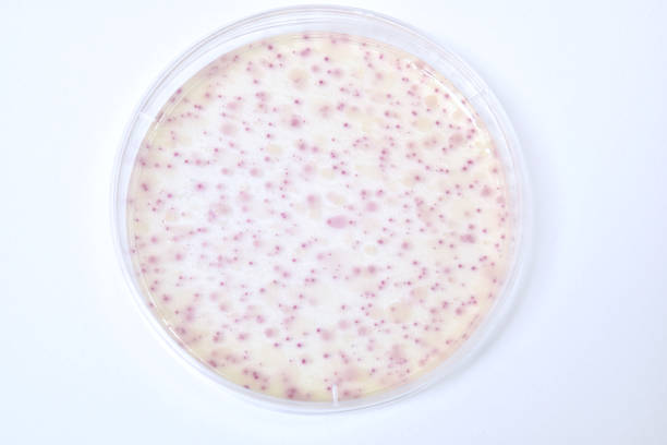 Colonies of bacteria growth on agar plate medium in laboratory.