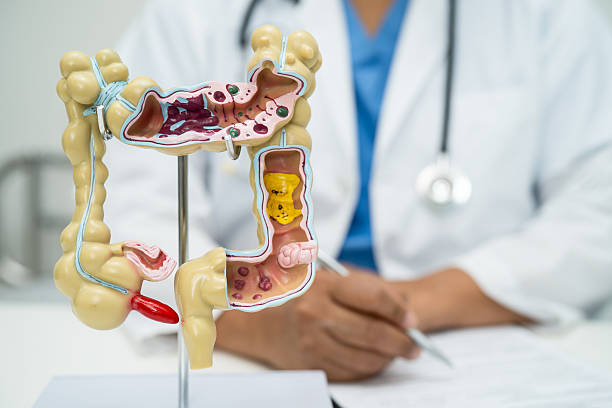 istock Intestine, appendix and digestive system, doctor holding anatomy model for study diagnosis and treatment in hospital. 2222240628