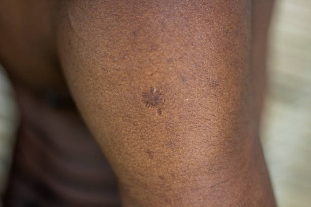 A black-skinned boys show his spot