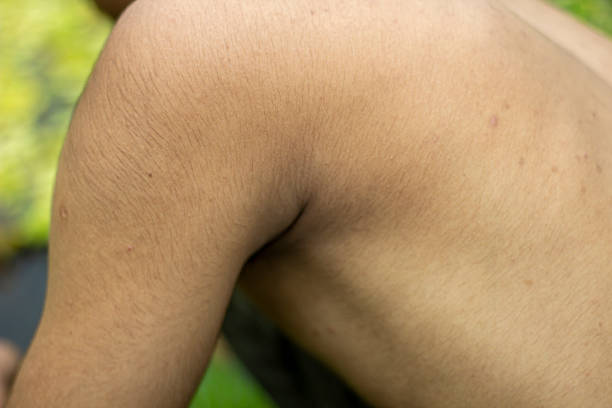 A fair-skinned boy's underarm area