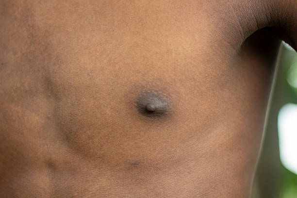 A black-skinned boys show his nipple