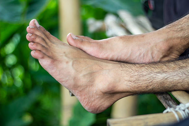 istock A fair-skinned boy's show his two leg 2222264530