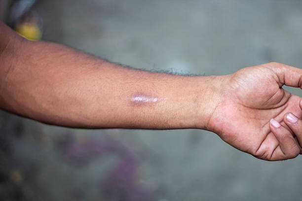 A young man shows his hand and background blur