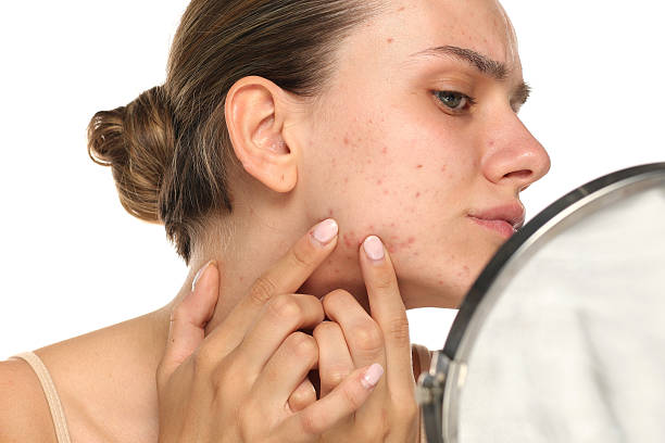 Studio shot of young woman examining acne on face in mirror on white background. Studio shot of young woman examining acne on face in mirror on white background face pimple breakouts stock pictures, royalty-free photos & images Studio shot of young woman examining acne on face in mirror on white background. Studio shot of young woman examining acne on face in mirror on white background face pimple breakouts stock pictures, royalty-free photos & images