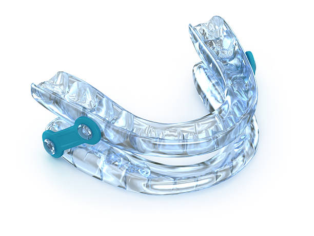 Oral appliance therapy device, sleep apnea treatment. 3D illustration