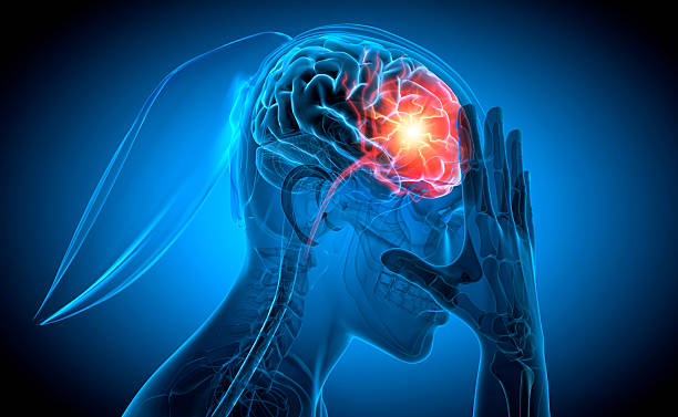 istock Woman with a strong headache 2223415343