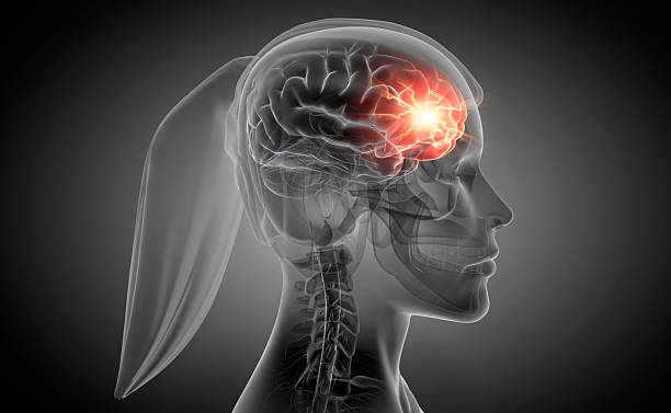 istock Woman with a strong headache 2223415348