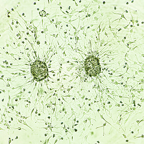 istock Glioblastoma cell spheroids. 2223450096