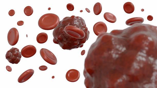 istock A blood tumor or a malignant cell amidst normal blood components. 2223496497