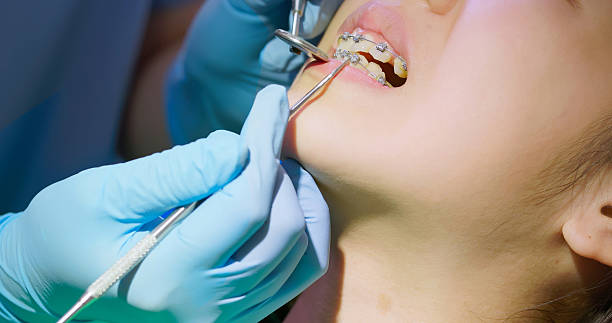 istock braces adjustment dental care 2223496593
