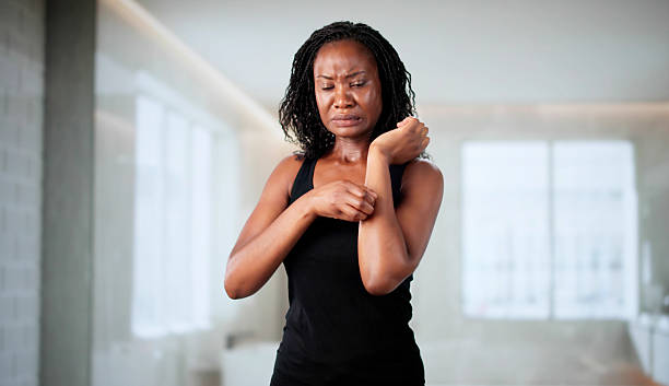 istock Woman Scratching Persistently Due To Allergic Dermatitis 2223628492