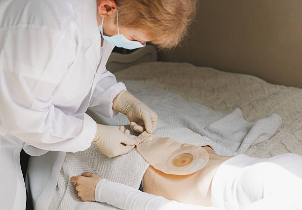istock An adult nurse changes a patient's colostomy bag. 2223715315