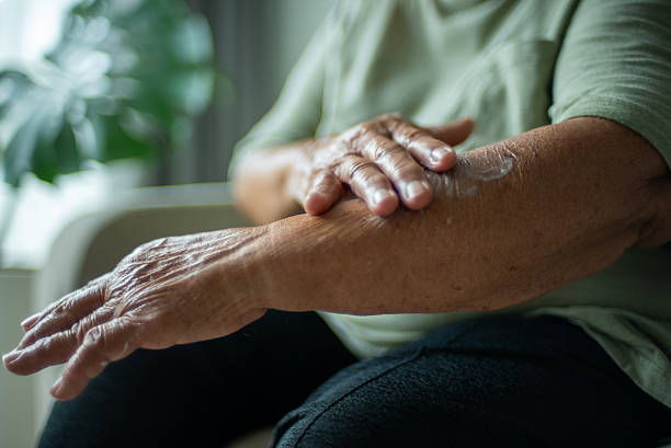 istock Senior woman applying arm cream. 2224059299