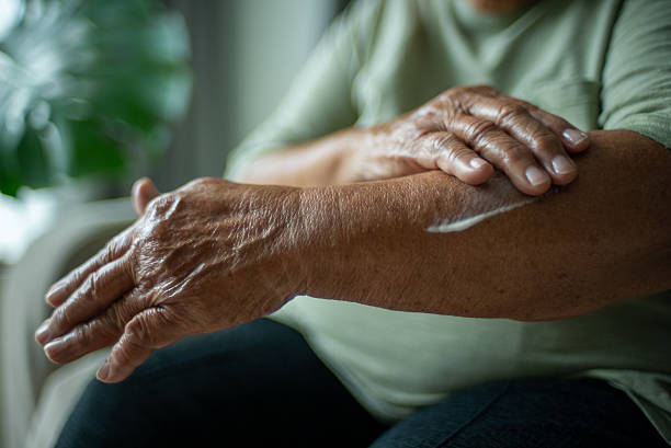 istock Senior woman applying arm cream. 2224059316