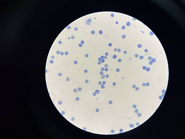 istock A reticulocyte is an immature red blood cell (RBC) that has recently been released from the bone marrow into the bloodstream. 2224402562