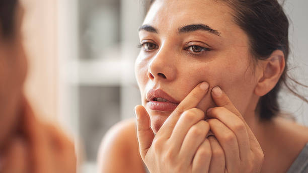 istock Woman squeezing a pimple or blackhead on her face 2224418942