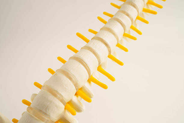 istock Spinal nerve and bone, Lumbar spine displaced herniated disc fragment, Model for treatment medical in the orthopedic department. 2224571639