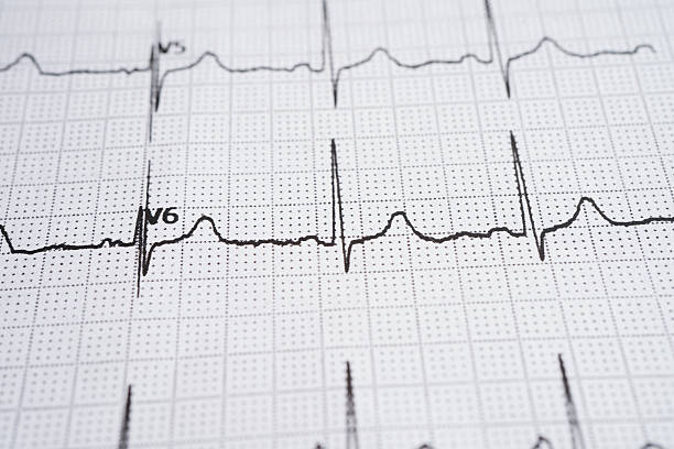 istock Electrocardiogram (ECG), heart wave, heart attack, cardiogram report. 2224611382