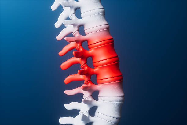 istock 3d rendering medical spine injury 2225052277