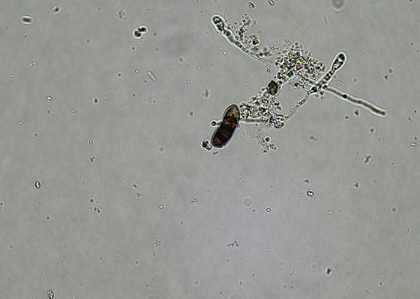 istock soil microorganisms under a microscope including amoeba, flagellates, nematodes, fungi, bacteria 2225300178