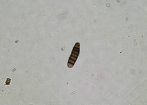 istock soil microorganisms under a microscope including amoeba, flagellates, nematodes, fungi, bacteria 2225301234
