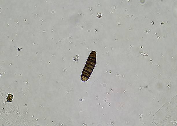 istock soil microorganisms under a microscope including amoeba, flagellates, nematodes, fungi, bacteria 2225301236