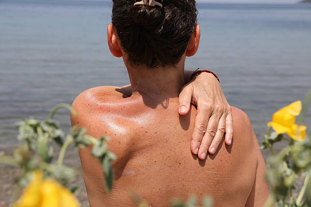 Close-Up Back View of a Woman Applying Sunscreen on Her Shoulder Near the Sea, with Yellow Flowers Blurred in the Foreground. A Summer Skincare Concept That Highlights Sun Protection, Natural Beauty, and Relaxing Outdoor Moments by the Water.