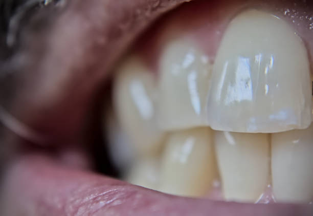 istock Dental oral hygiene macro details view 2225594809