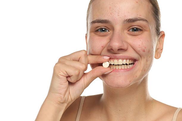 istock Smiling young woman with acne holding a pill, studio shot on white background 2225616544