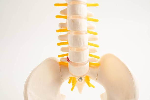 istock Spinal nerve and bone, Lumbar spine displaced herniated disc fragment, Model for treatment medical in the orthopedic department. 2225825113