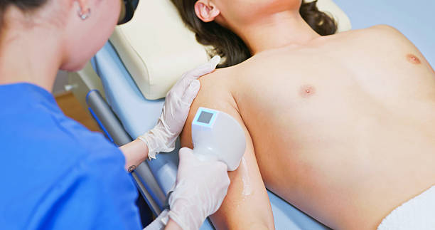 istock male laser arm hair removal 2225995231