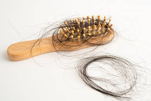 istock Hair loss fall with comb brush isolated on white background. 2226265869
