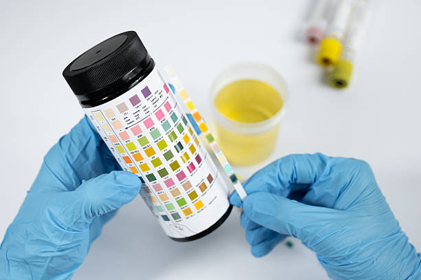 istock Doctor analyzing urine sample with test strip in laboratory 2226273873