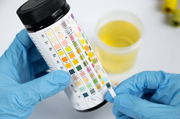 istock Doctor analyzing urine sample with test strip in laboratory 2226273878