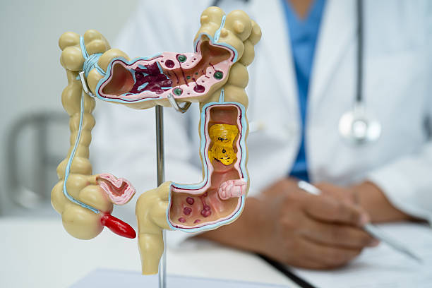istock Intestine, appendix and digestive system, doctor holding anatomy model for study diagnosis and treatment in hospital. 2226424305