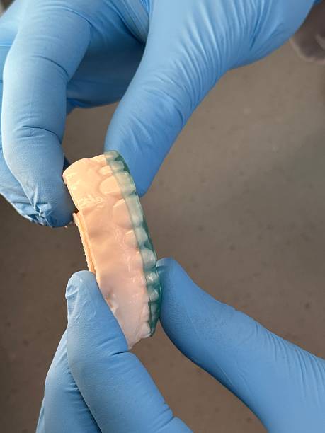 istock occlusal splint or occlusal guard 2226590675