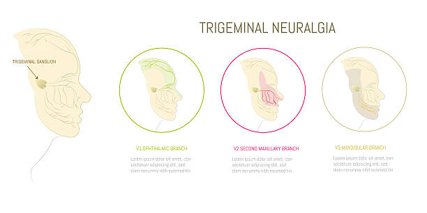 neuralgie trojklaného nervu s očními, maxilárními a mandibulárními větvemi - ganglion stock ilustrace