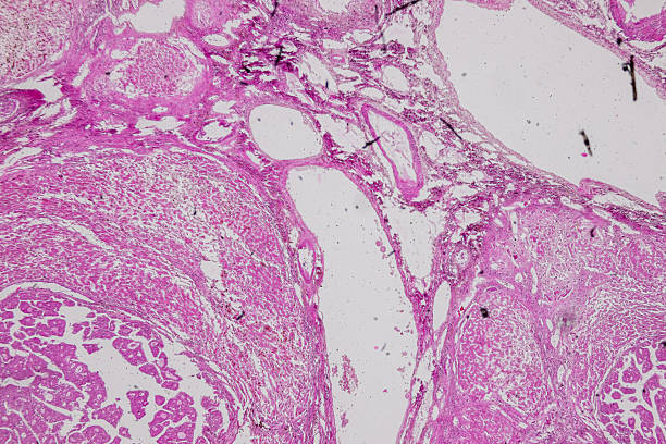 istock Pathology and Histology Tissue of Mammals under microscope. 2226889307