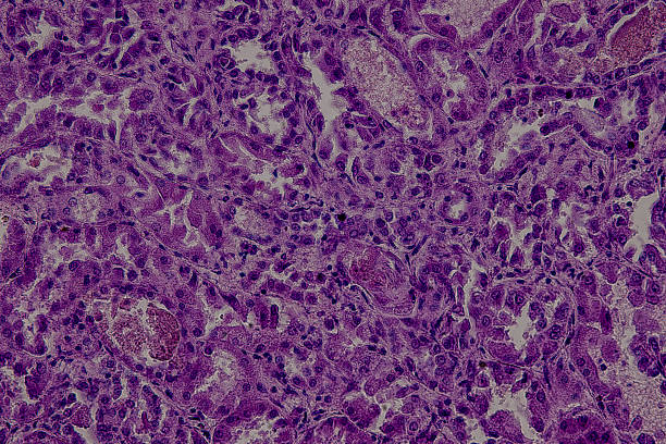 istock Pathology and Histology Tissue of Mammals under microscope. 2226889322