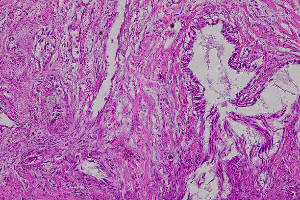 istock Pathology and Histology Tissue of Mammals under microscope. 2226889421
