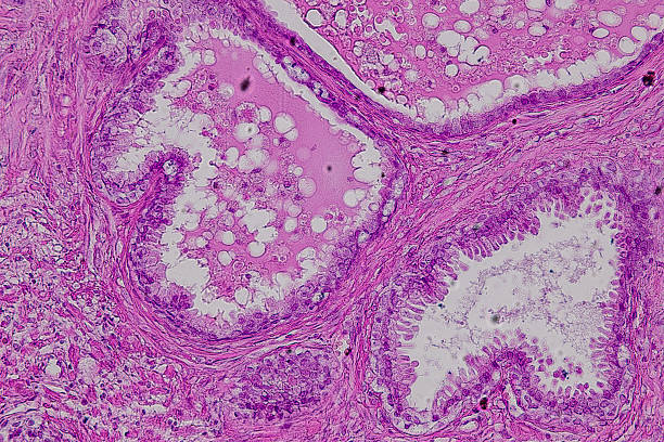 istock Pathology and Histology Tissue of Mammals under microscope. 2226889428