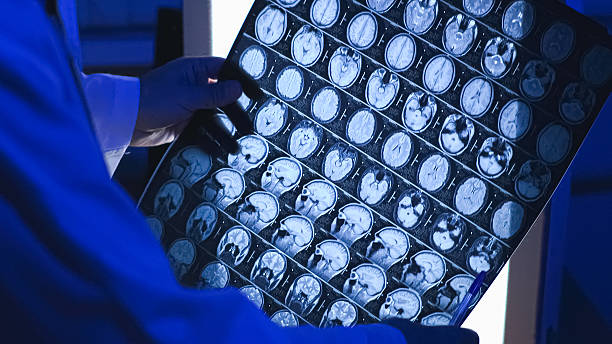 istock Doctor and mri 2227104396