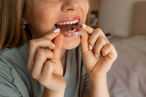 istock Woman inserting transparent dental aligner for teeth correction therapy at home 2227846043