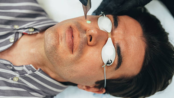 Man wearing protective goggles receives a laser skin treatment on his face at a modern clinic. A professional in black gloves operates the laser device, highlighting advanced skincare technology and professional care.