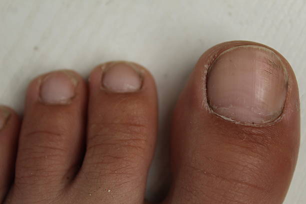 Toes close-up on a white light background. Healthy toenails.