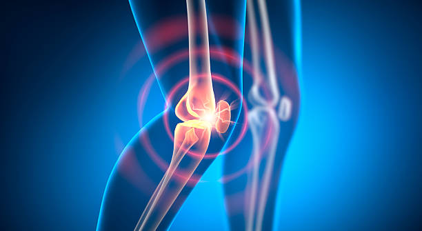 istock Legs with pain in knee joint 2228492436