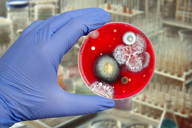 istock Bacterial and mold fungi colonies grown from hands surface on blood sheep agar 2228771477
