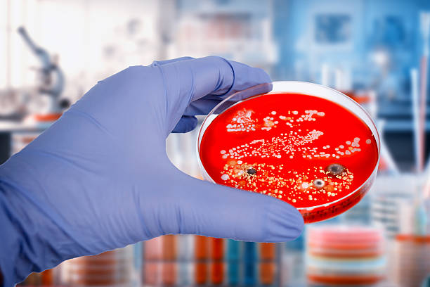 istock Bacterial and mold fungi colonies grown from hands surface on blood sheep agar 2228771483