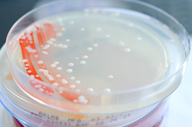 istock Isolated bacterial colonies on potato dextrose agar 2228772183